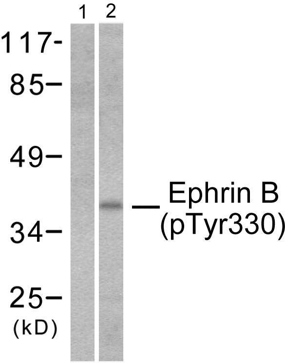 Ephrin B1+B2 Antibody - Western blot analysis of lysates from 293 cells treated with TNF-a 20ng/ml 30', using EFNB1/2 (Phospho-Tyr330) Antibody. The lane on the left is blocked with the phospho peptide.