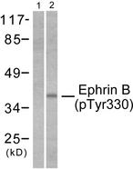 Ephrin B1+B2 Antibody - Western blot analysis of lysates from 293 cells treated with TNF-a 20ng/ml 30', using EFNB1/2 (Phospho-Tyr330) Antibody. The lane on the left is blocked with the phospho peptide.