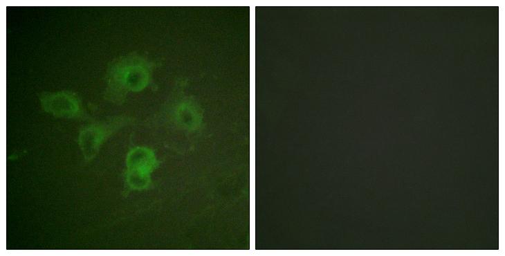 Ephrin B1+B2 Antibody - P-peptide - + Immunofluorescence analysis of HuvEc cells, using EPHB1/2 (Phospho-Tyr594/604) antibody.