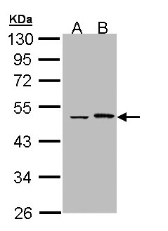 EPHX1 / Epoxide Hydrolase 1 Antibody - Sample (30 ug of whole cell lysate). A: Hela, B: Hep G2 . 10% SDS PAGE. EPHX / Epoxide Hydrolase antibody diluted at 1:1000.