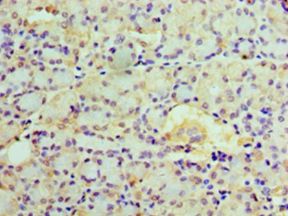 EPHX1 / Epoxide Hydrolase 1 Antibody - Immunohistochemistry of paraffin-embedded human pancreas tissue using antibody at 1:100 dilution.  This image was taken for the unconjugated form of this product. Other forms have not been tested.