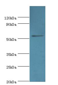 EPHX1 / Epoxide Hydrolase 1 Antibody - Western blot. All lanes: Epoxide hydrolase 1 antibody at 2 ug/ml+HeLa whole cell lysate. Secondary antibody: goat polyclonal to rabbit at 1:10000 dilution. Predicted band size: 53 kDa. Observed band size: 53 kDa.  This image was taken for the unconjugated form of this product. Other forms have not been tested.