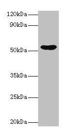 EPHX1 / Epoxide Hydrolase 1 Antibody - Western blot All lanes: Epoxide hydrolase 1 antibody at 2µg/ml + Hela whole cell lysate Secondary Goat polyclonal to rabbit IgG at 1/10000 dilution Predicted band size: 53 kDa Observed band size: 53 kDa