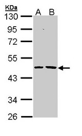 EPHX1 / Epoxide Hydrolase 1 Antibody - Sample (30 ug of whole cell lysate). A: H1299, B: Hela. 10% SDS PAGE. EPHX / Epoxide Hydrolase antibody diluted at 1:1000