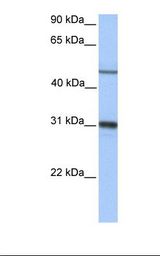 EPHX1 / Epoxide Hydrolase 1 Antibody - Fetal liver lysate. Antibody concentration: 1.0 ug/ml. Gel concentration: 12%.  This image was taken for the unconjugated form of this product. Other forms have not been tested.