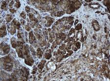 EPHX1 / Epoxide Hydrolase 1 Antibody - IHC of paraffin-embedded Human pancreas tissue using anti-EPHX1 mouse monoclonal antibody. (Heat-induced epitope retrieval by 10mM citric buffer, pH6.0, 100C for 10min).