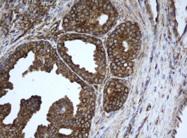 EPHX1 / Epoxide Hydrolase 1 Antibody - IHC of paraffin-embedded Human prostate tissue using anti-EPHX1 mouse monoclonal antibody. (Heat-induced epitope retrieval by 10mM citric buffer, pH6.0, 100C for 10min).