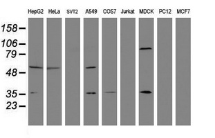 EPHX1 / Epoxide Hydrolase 1 Antibody - Western blot of extracts (35ug) from 9 different cell lines by using anti-EPHX1 monoclonal antibody (HepG2: human; HeLa: human; SVT2: mouse; A549: human; COS7: monkey; Jurkat: human; MDCK: canine; PC12: rat; MCF7: human).