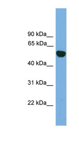 EPHX1 / Epoxide Hydrolase 1 Antibody - EPHX1 antibody Western blot of Jurkat lysate. This image was taken for the unconjugated form of this product. Other forms have not been tested.