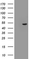 EPHX1 / Epoxide Hydrolase 1 Antibody - HEK293T cells were transfected with the pCMV6-ENTRY control (Left lane) or pCMV6-ENTRY EPHX1 (Right lane) cDNA for 48 hrs and lysed. Equivalent amounts of cell lysates (5 ug per lane) were separated by SDS-PAGE and immunoblotted with anti-EPHX1.