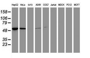 EPHX1 / Epoxide Hydrolase 1 Antibody - Western blot of extracts (35 ug) from 9 different cell lines by using anti-EPHX1 monoclonal antibody (HepG2: human; HeLa: human; SVT2: mouse; A549: human; COS7: monkey; Jurkat: human; MDCK: canine; PC12: rat; MCF7: human).