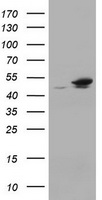 EPHX1 / Epoxide Hydrolase 1 Antibody - HEK293T cells were transfected with the pCMV6-ENTRY control (Left lane) or pCMV6-ENTRY EPHX1 (Right lane) cDNA for 48 hrs and lysed. Equivalent amounts of cell lysates (5 ug per lane) were separated by SDS-PAGE and immunoblotted with anti-EPHX1.