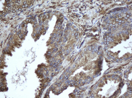 EPHX1 / Epoxide Hydrolase 1 Antibody - IHC of paraffin-embedded Human prostate tissue using anti-EPHX1 mouse monoclonal antibody.