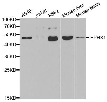 EPHX1 / Epoxide Hydrolase 1 Antibody - Western blot analysis of extracts of various cell lines.
