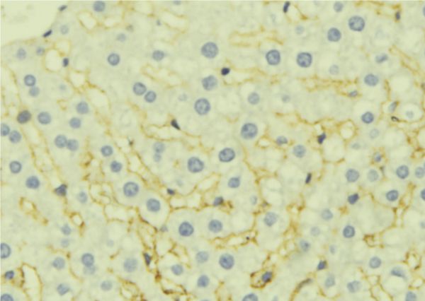 EPHX1 / Epoxide Hydrolase 1 Antibody - 1:100 staining mouse liver tissue by IHC-P. The sample was formaldehyde fixed and a heat mediated antigen retrieval step in citrate buffer was performed. The sample was then blocked and incubated with the antibody for 1.5 hours at 22°C. An HRP conjugated goat anti-rabbit antibody was used as the secondary.