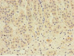 EPHX2 / Epoxide Hydrolase 2 Antibody - Immunohistochemistry of paraffin-embedded human adrenal gland using antibody at 1: 100 dilution.  This image was taken for the unconjugated form of this product. Other forms have not been tested.
