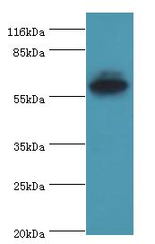 EPHX2 / Epoxide Hydrolase 2 Antibody - Western blot. All lanes: EPHX2 antibody at 2 ug/ml+MCF-7 whole cell lysate. Secondary antibody: goat polyclonal to rabbit at 1:10000 dilution. Predicted band size: 57 kDa. Observed band size: 57 kDa.  This image was taken for the unconjugated form of this product. Other forms have not been tested.