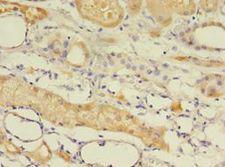 EPHX2 / Epoxide Hydrolase 2 Antibody - Immunohistochemistry of paraffin-embedded human kidney using antibody at 1:100 dilution.  This image was taken for the unconjugated form of this product. Other forms have not been tested.