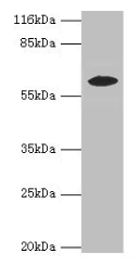 EPHX2 / Epoxide Hydrolase 2 Antibody - Western blot All lanes: EPHX2 antibody at 2µg/ml + MCF-7 whole cell lysate Secondary Goat polyclonal to rabbit IgG at 1/10000 dilution Predicted band size: 63, 58, 56 kDa Observed band size: 58 kDa