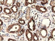 EPHX2 / Epoxide Hydrolase 2 Antibody - IHC of paraffin-embedded Human Kidney tissue using anti-EPHX2 mouse monoclonal antibody.