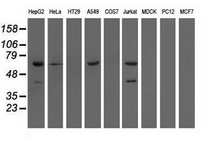 EPHX2 / Epoxide Hydrolase 2 Antibody - Western blot of extracts (35 ug) from 9 different cell lines by using anti-EPHX2 monoclonal antibody.