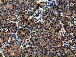 EPHX2 / Epoxide Hydrolase 2 Antibody - IHC of paraffin-embedded Human pancreas tissue using anti-EPHX2 mouse monoclonal antibody.