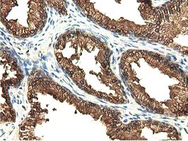 EPHX2 / Epoxide Hydrolase 2 Antibody - IHC of paraffin-embedded Human prostate tissue using anti-EPHX2 mouse monoclonal antibody.