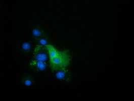 EPHX2 / Epoxide Hydrolase 2 Antibody - Anti-EPHX2 mouse monoclonal antibody  immunofluorescent staining of COS7 cells transiently transfected by pCMV6-ENTRY EPHX2.