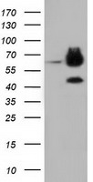 EPHX2 / Epoxide Hydrolase 2 Antibody - HEK293T cells were transfected with the pCMV6-ENTRY control (Left lane) or pCMV6-ENTRY EPHX2 (Right lane) cDNA for 48 hrs and lysed. Equivalent amounts of cell lysates (5 ug per lane) were separated by SDS-PAGE and immunoblotted with anti-EPHX2.