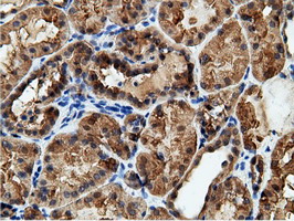 EPHX2 / Epoxide Hydrolase 2 Antibody - Immunohistochemical staining of paraffin-embedded Human Kidney tissue using anti-EPHX2 mouse monoclonal antibody.