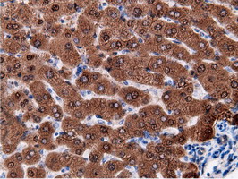 EPHX2 / Epoxide Hydrolase 2 Antibody - Immunohistochemical staining of paraffin-embedded Human liver tissue using anti-EPHX2 mouse monoclonal antibody.