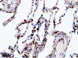 EPHX2 / Epoxide Hydrolase 2 Antibody - Immunohistochemical staining of paraffin-embedded Human lung tissue using anti-EPHX2 mouse monoclonal antibody.