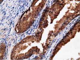 EPHX2 / Epoxide Hydrolase 2 Antibody - Immunohistochemical staining of paraffin-embedded Human prostate tissue using anti-EPHX2 mouse monoclonal antibody.
