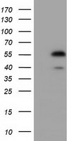 EPHX2 / Epoxide Hydrolase 2 Antibody - HEK293T cells were transfected with the pCMV6-ENTRY control (Left lane) or pCMV6-ENTRY EPHX2 (Right lane) cDNA for 48 hrs and lysed. Equivalent amounts of cell lysates (5 ug per lane) were separated by SDS-PAGE and immunoblotted with anti-EPHX2.