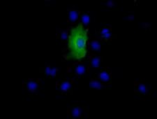 EPHX2 / Epoxide Hydrolase 2 Antibody - Anti-EPHX2 mouse monoclonal antibody  immunofluorescent staining of COS7 cells transiently transfected by pCMV6-ENTRY EPHX2.