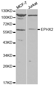 EPHX2 / Epoxide Hydrolase 2 Antibody - Western blot analysis of extracts of various cell lines.