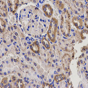 EPHX2 / Epoxide Hydrolase 2 Antibody - Immunohistochemistry of paraffin-embedded rat kidney tissue.