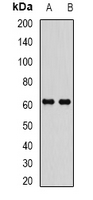 EPHX2 / Epoxide Hydrolase 2 Antibody - Western blot analysis of EPHX2 expression in MCF7 (A); Jurkat (B) whole cell lysates.