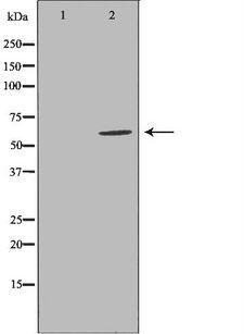 EPHX2 / Epoxide Hydrolase 2 Antibody - Western blot analysis of Jurkat cell lysates using EPXH2 antibody. The lane on the left is treated with the antigen-specific peptide.