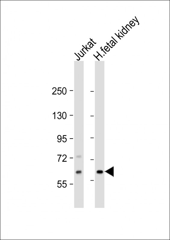 EPHX2 / Epoxide Hydrolase 2 Antibody - All lanes: Anti-EPHX2 Antibody (N-Term) at 1:2000 dilution Lane 1: Jurkat whole cell lysate Lane 2: human fetal kidney lysate Lysates/proteins at 20 µg per lane. Secondary Goat Anti-Rabbit IgG, (H+L), Peroxidase conjugated at 1/10000 dilution. Predicted band size: 63 kDa Blocking/Dilution buffer: 5% NFDM/TBST.