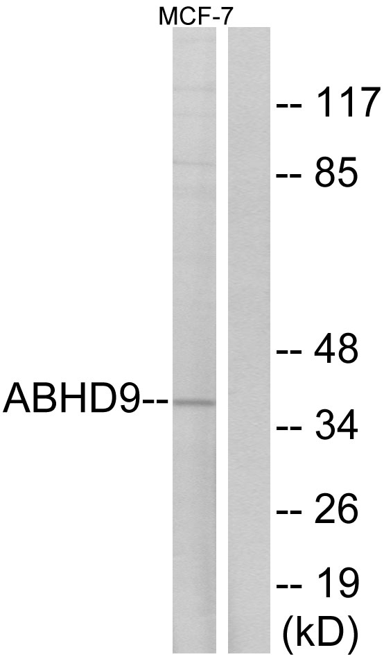 EPHX3 / Epoxide Hydrolase 3 Antibody - Western blot analysis of lysates from MCF-7 cells, using ABHD9 Antibody. The lane on the right is blocked with the synthesized peptide.