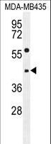 EPHX3 / Epoxide Hydrolase 3 Antibody - EPHX3 Antibody western blot of MDA-MB435 cell line lysates (35 ug/lane). The EPHX3 antibody detected the EPHX3 protein (arrow).