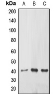 EPHX3 / Epoxide Hydrolase 3 Antibody - Western blot analysis of ABHD9 expression in HEK239T (A); mouse kidney (B); rat kidney (C) whole cell lysates.