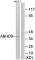 EPHX3 / Epoxide Hydrolase 3 Antibody - Western blot analysis of extracts from MCF-7 cells, using ABHD9 antibody.