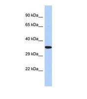 EPHX4 / Epoxide Hydrolase 4 Antibody - Western blot of Human HepG2. EPHX4 antibody dilution 1.0 ug/ml.  This image was taken for the unconjugated form of this product. Other forms have not been tested.