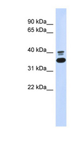 EPHX4 / Epoxide Hydrolase 4 Antibody - EPHX4 antibody Western blot of 293T cell lysate. This image was taken for the unconjugated form of this product. Other forms have not been tested.