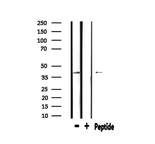 EPHX4 / Epoxide Hydrolase 4 Antibody - Western blot analysis of extracts of rat brain tissue using ABHD7 antibody.