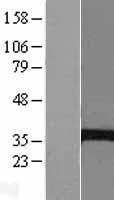 EPHX4 / Epoxide Hydrolase 4 Protein - Western validation with an anti-DDK antibody * L: Control HEK293 lysate R: Over-expression lysate