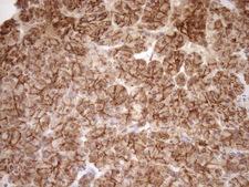 EPLIN Antibody - Immunohistochemical staining of paraffin-embedded Human pancreas tissue within the normal limits using anti-LIMA1 mouse monoclonal antibody. (Heat-induced epitope retrieval by 1mM EDTA in 10mM Tris buffer. (pH8.5) at 120°C for 3 min. (1:150)