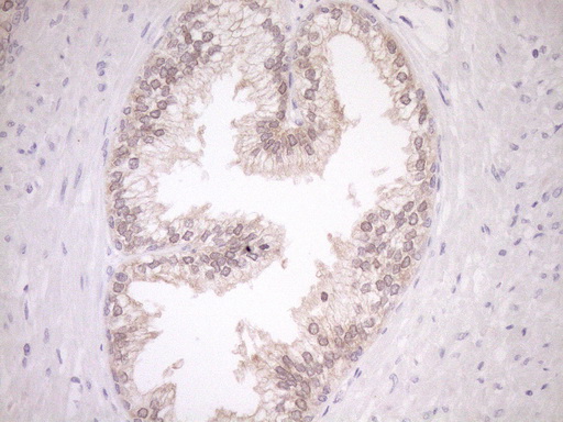 EPLIN Antibody - Immunohistochemical staining of paraffin-embedded Human prostate tissue within the normal limits using anti-LIMA1 mouse monoclonal antibody. (Heat-induced epitope retrieval by 1mM EDTA in 10mM Tris buffer. (pH8.5) at 120°C for 3 min. (1:150)